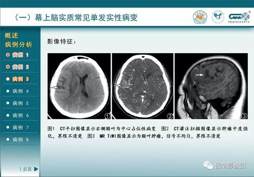 探究神经网络算法在图像识别中的应用