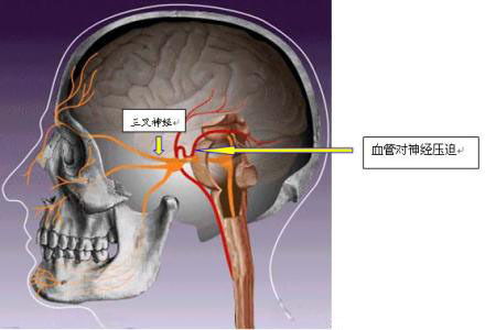 探究神经网络算法在图像识别中的应用