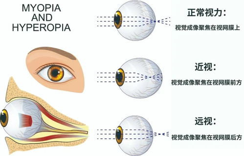 瞳术之谜-探究宇智波斑的眼睛