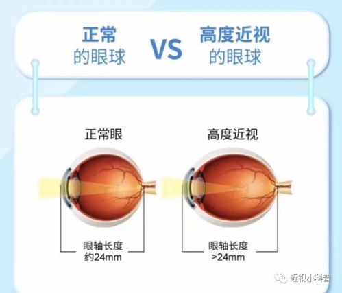 瞳术之谜-探究宇智波斑的眼睛