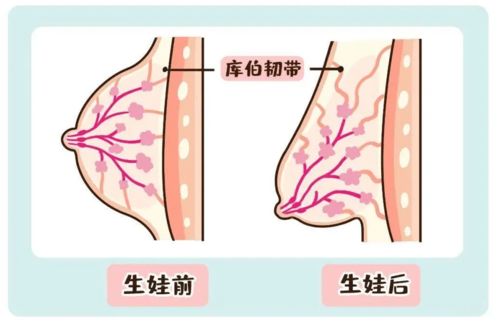 如何挑选适合自己的内衣？从尚衣监内衣品牌说起