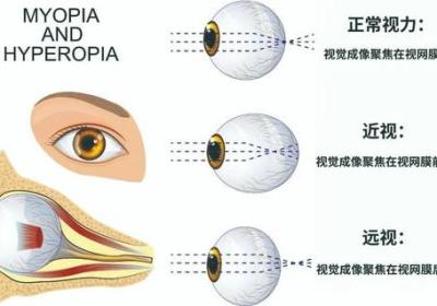 瞳术之谜-探究宇智波斑的眼睛