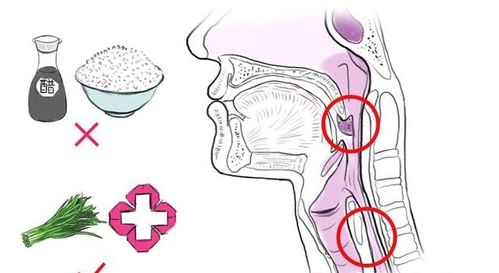 喉咙卡鱼刺的紧急处理方法,喉咙卡鱼刺的紧急处理方法,第1张